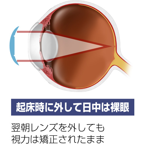 起床時に外して日中は裸眼